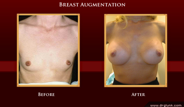 Before and After Photo