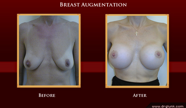 Before and After Photo