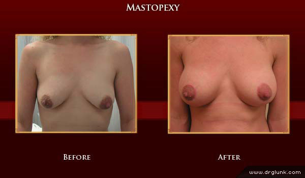 Before and After Photo