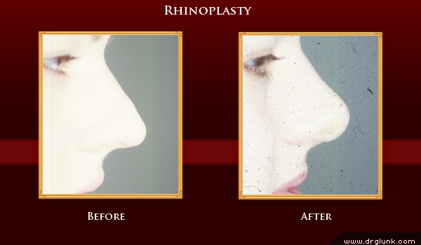 Before and After Photo